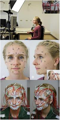 High-resolution surface electromyographic activities of facial muscles during mimic movements in healthy adults: A prospective observational study